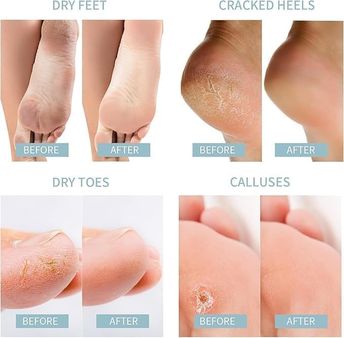 UCRAVO Softening Coconut Oil Foot Mask, Gentle Exfoliate & Hydrate Feet, Nourishing Moisturizing for Dry Rough & Cracked Heels, 2 Pair, No Alcohol Sulphate or Colorant, Deep Repair Spa Kit