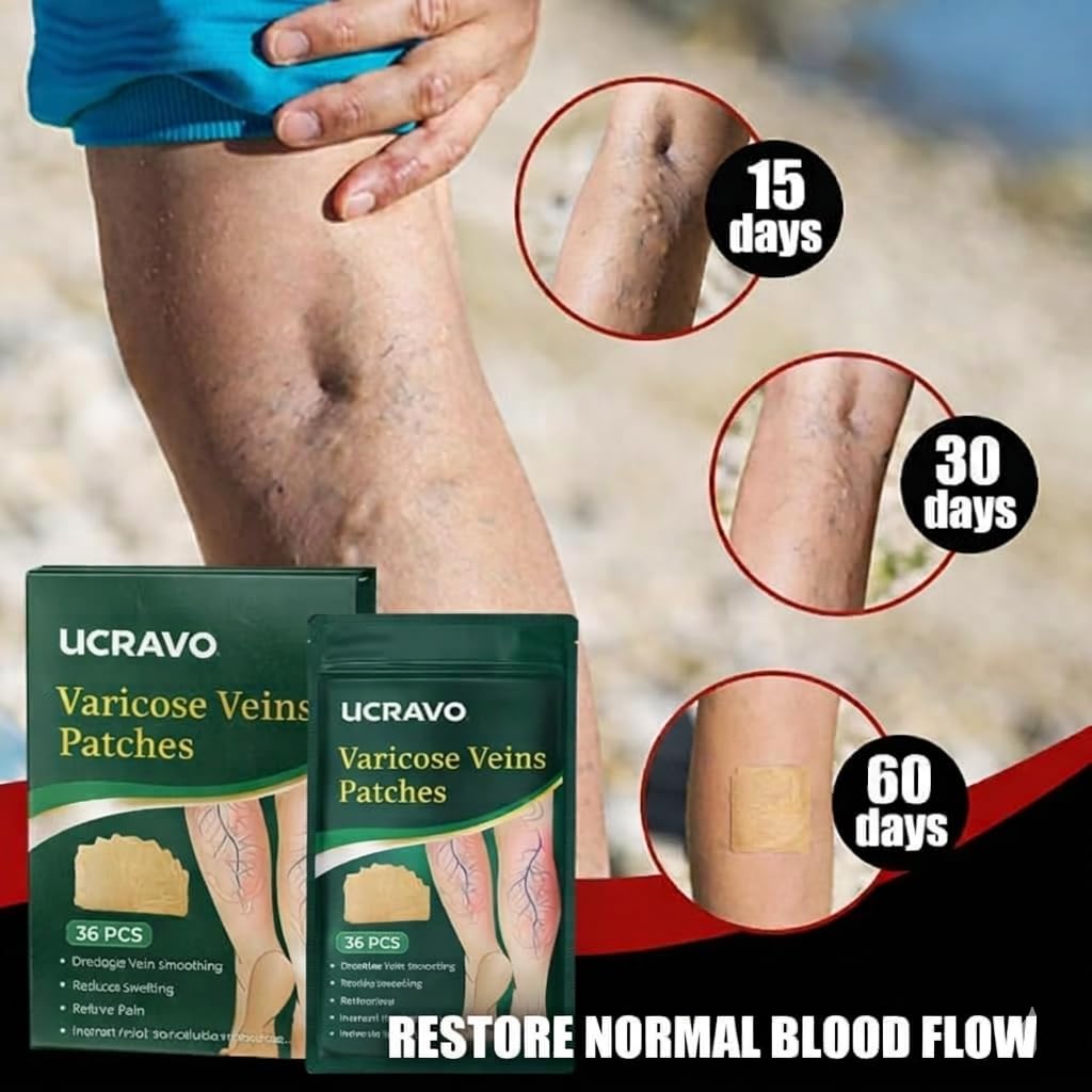 UCRAVO Varicose Veins Patch 36 PCS Herbal Vein Care Patch for Leg Swelling,Spider Veins,Muscle Pain Relief,Improve Blood Circulation,Deep Vein Support,Skin Friendly Pain Relief Patch for Men & Women