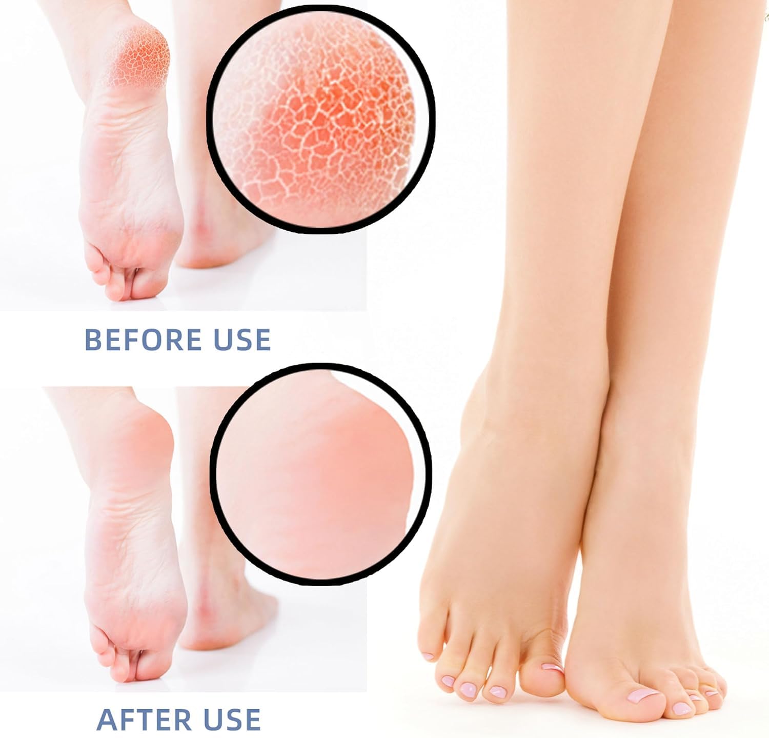 UCRAVO Silicone Heel Protectors, 1 Pair Gel Heel Cushions for Dry Cracked Heels, Plantar Fasciitis & Pain Relief, Breathable Reusable Moisturizing Heel Sleeves for Men & Women for Foot Care