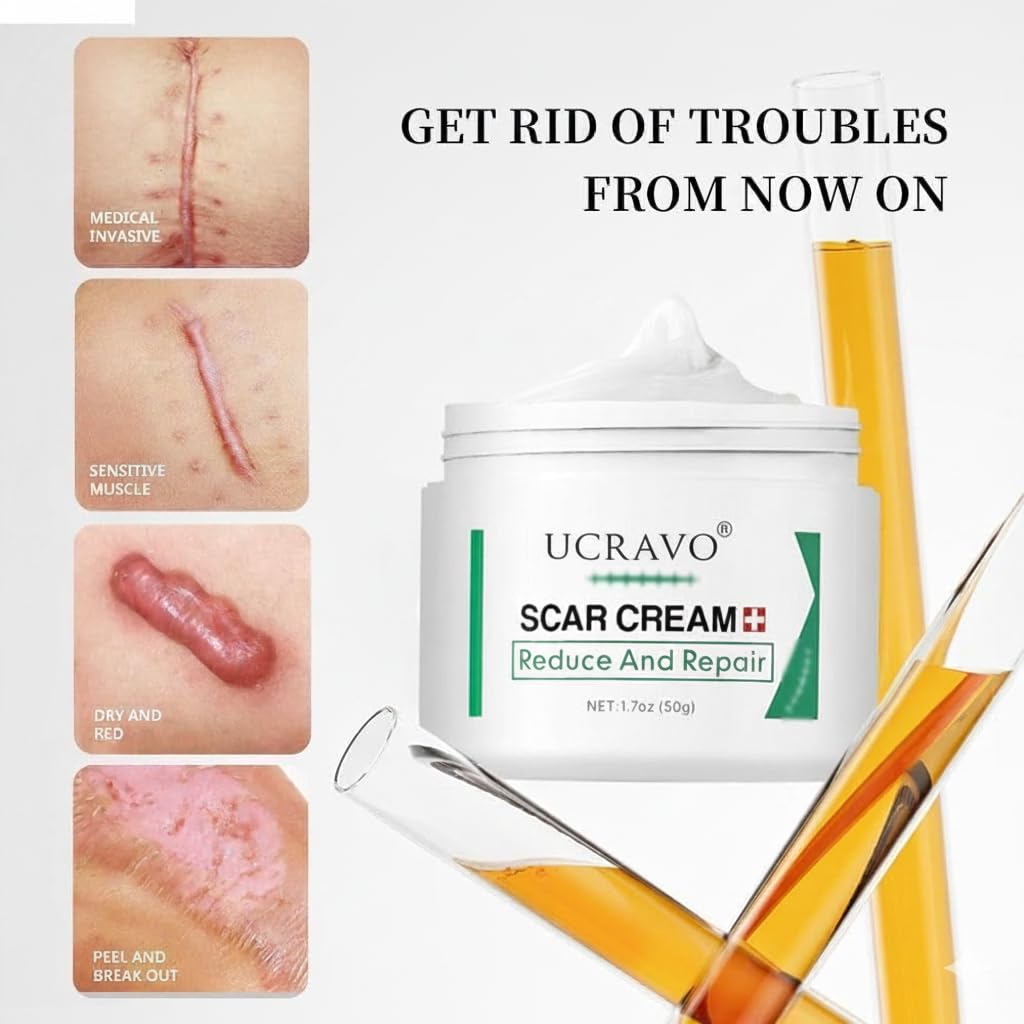 UCRAVO Scar Cream for Face & Body Advanced Scar Removal Cream for Old & New Scars Acne Scars, Stretch Marks, Burn Marks, Surgical Scar Repair Cream Fast Absorbing Non Greasy Skin Repair Formula (50g)