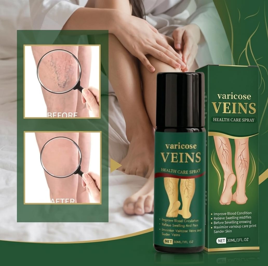 UCRAVO Varicose Veins Relief Spray for Legs & Feet | Herbal Vein Treatment Oil | Reduces Swelling, Pain & Spider Veins | Improves Blood Circulation Natural Fast Acting Leg Care Spray for Men & Women