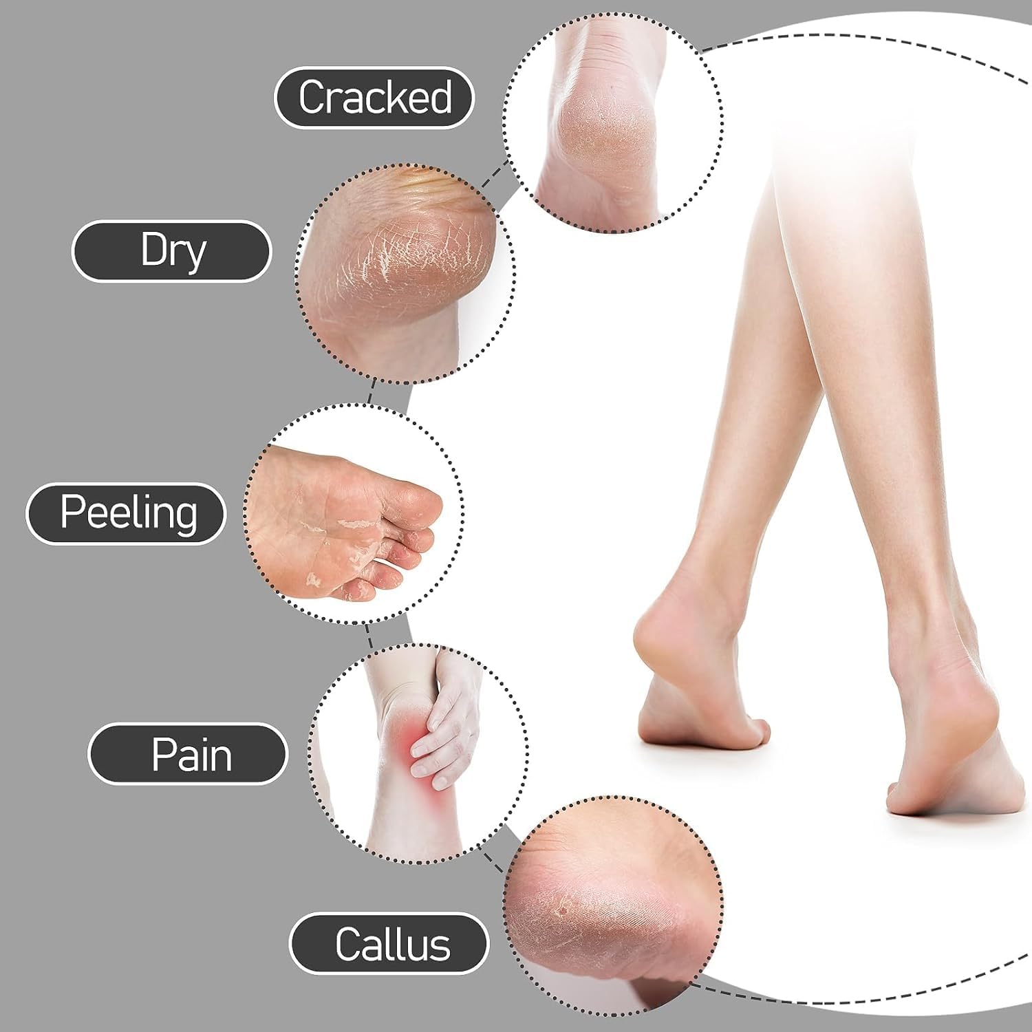 UCRAVO Silicone Gel Heel Socks for Cracked Heel Repair, Moisturizing Heel Sleeves for Dry Hard Heels,Pain Relief, Plantar Fasciitis Support,Reusable Protector Pads for Men & Women Foot Care