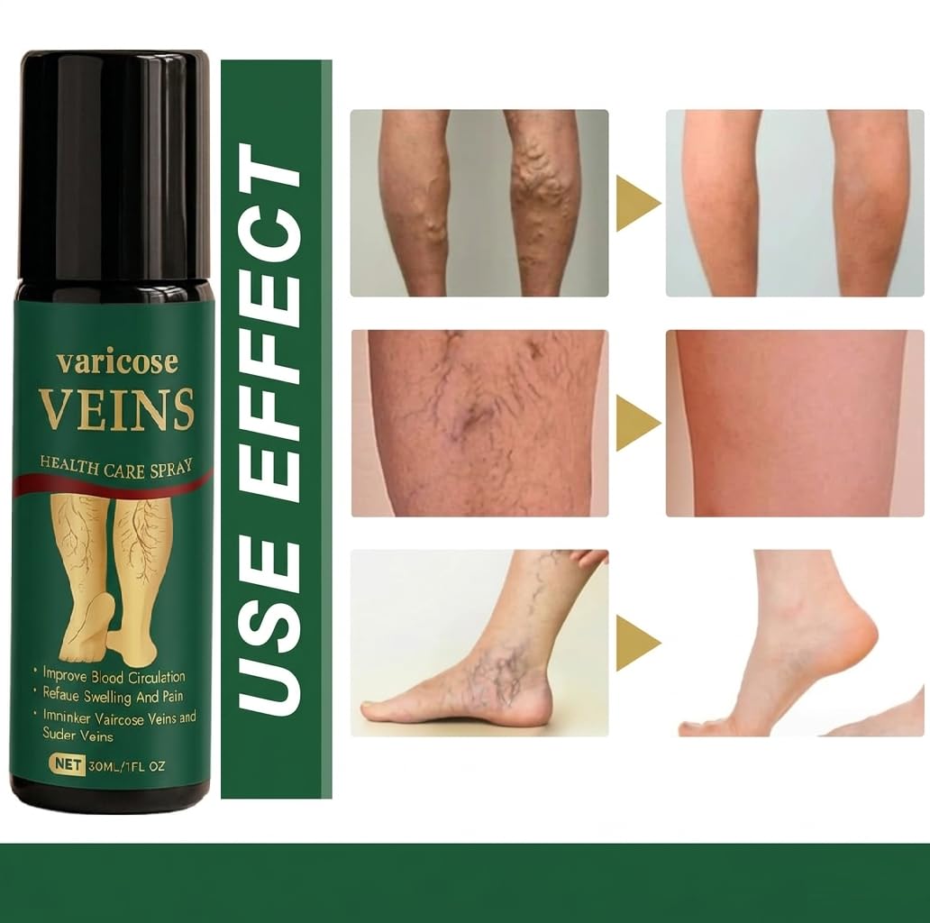 UCRAVO Varicose Veins Relief Spray for Legs & Feet | Herbal Vein Treatment Oil | Reduces Swelling, Pain & Spider Veins | Improves Blood Circulation Natural Fast Acting Leg Care Spray for Men & Women