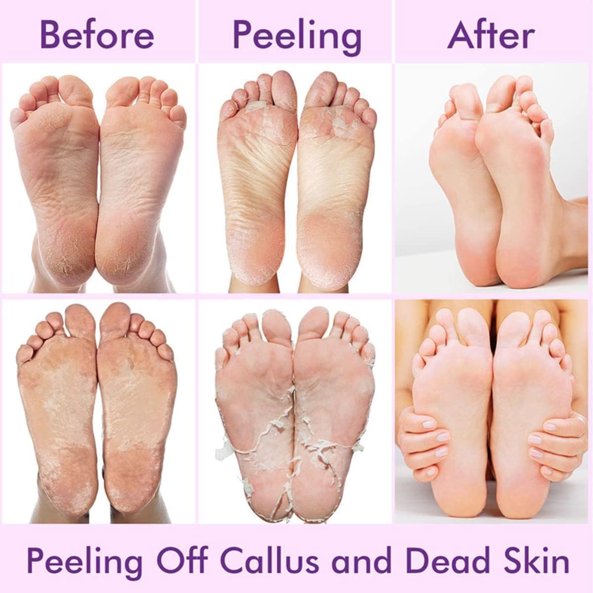 UCRAVO Foot Peeling Mask Purple for Dead Skin Removal, Exfoliating Foot Peel Mask Socks for Cracked Heels, Callus Remover, Hard Skin Repair, Baby Soft Smooth Feet Spa Treatment for Men & Women (1Pair)