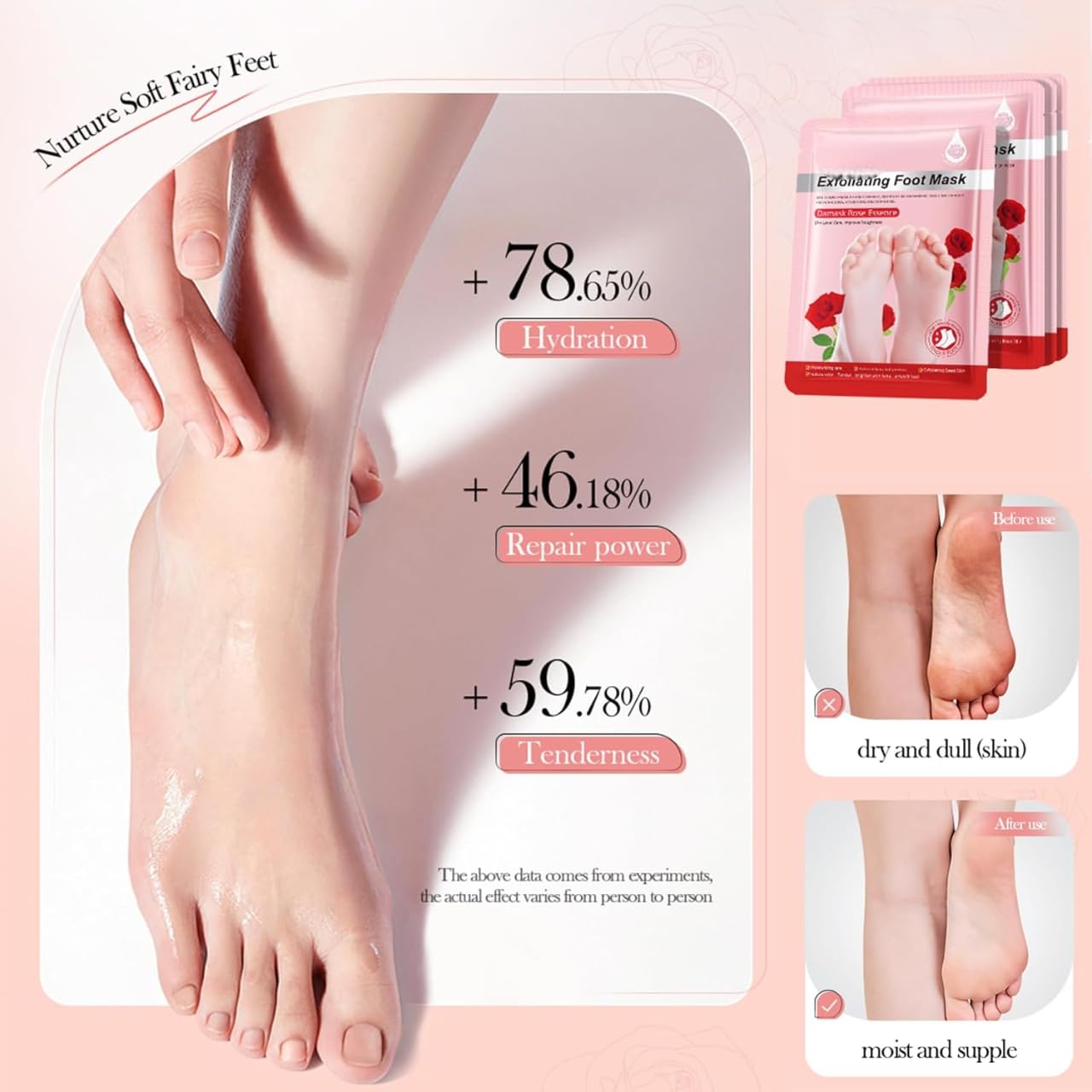 UCRAVO Red Foot Peeling Mask for Dead Skin Removal, Exfoliating Foot Peel Mask Socks for Cracked Heels, Callus & Dry Feet Repair, Baby Soft Smooth Feet Spa Treatment at Home for Men & Women (1 Pair)