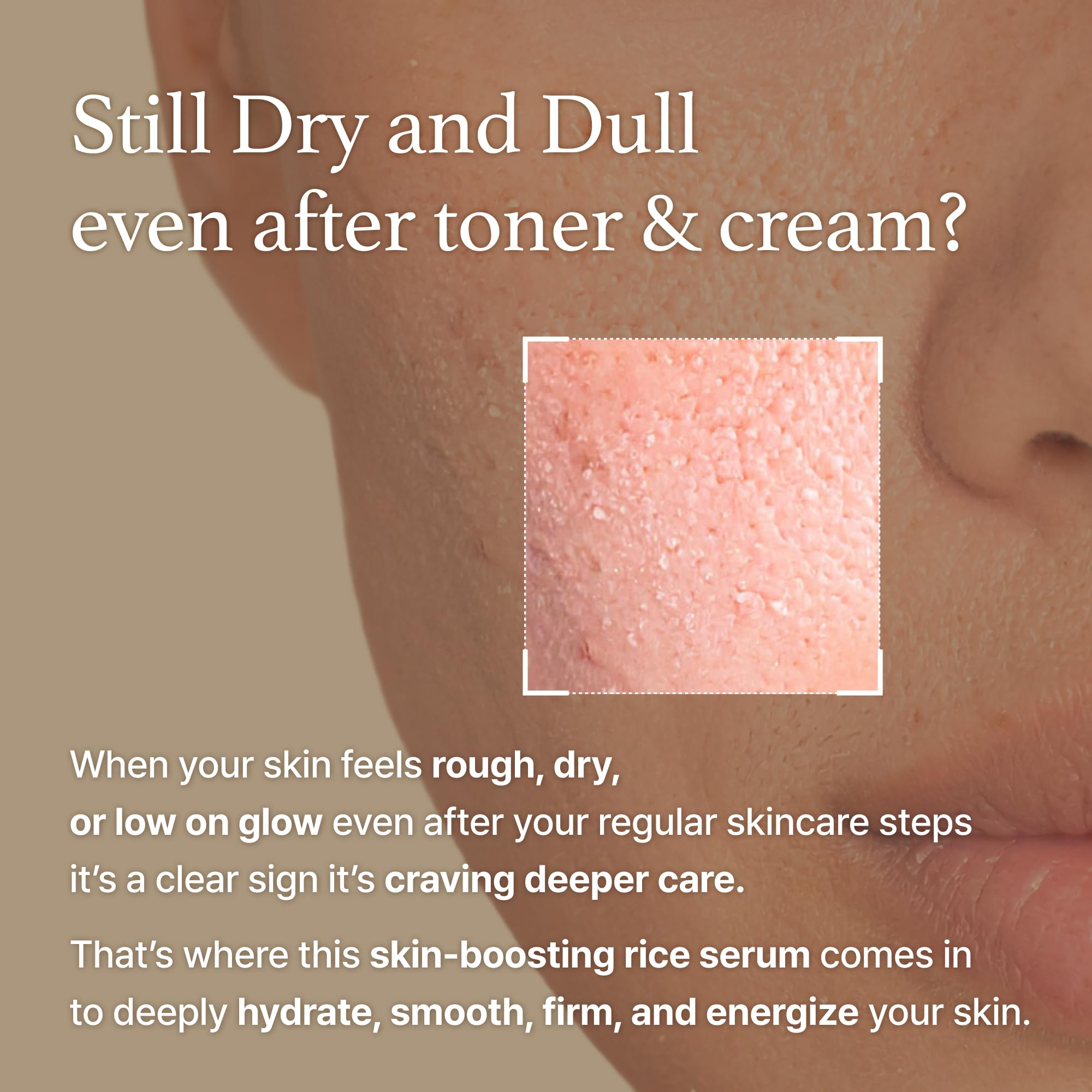 UCRAVO Rice Serum, Korean Fermented Rice Embryo Extract Boosts Collagen, Vitality, Radiant Glowing Skin, Niacinamide, Vitality to Dull Skin, Nourishing, Moisturizing