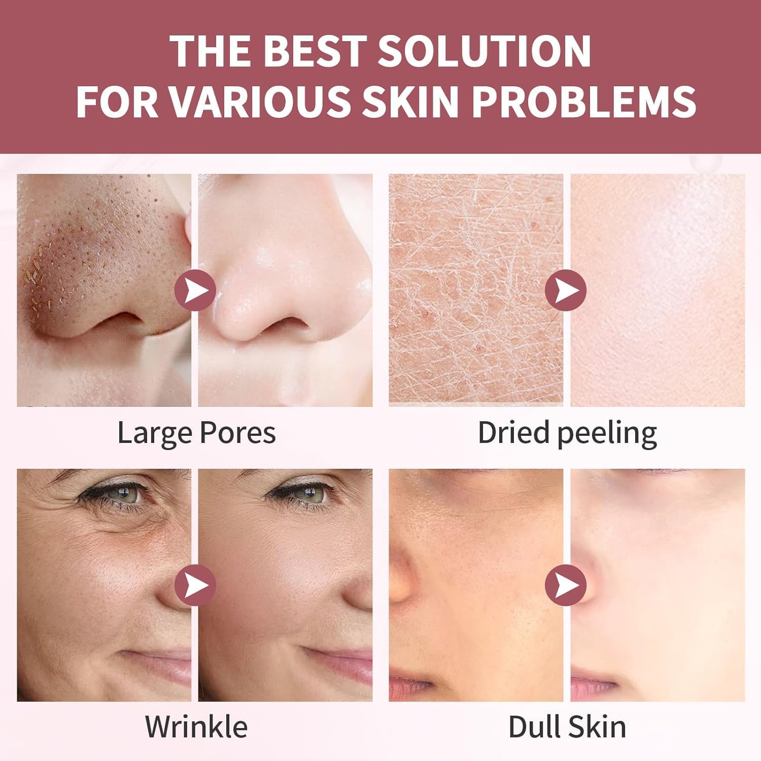 UCRAVO 6 Sheets Bio-Collagen Real Deep Mask, Hydrating Overnight Hydrogel Mask, Pore Minimizing, Elasticity, Plumping Improvement, Korean Skin Care, Valentines Day Gifts for Her