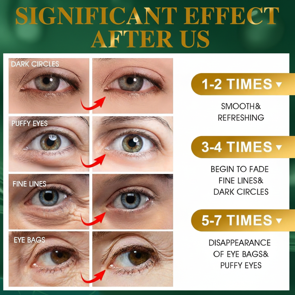 UCRAVO Seaweed Hydrating Eye Mask – Under Eye Patches with Marine Algae, Hyaluronic Acid & Collagen – Dark Circle Remover, Puffy Eye & Wrinkle Treatment – Cooling Moisturizing Eye Gel Pads for Men & Women